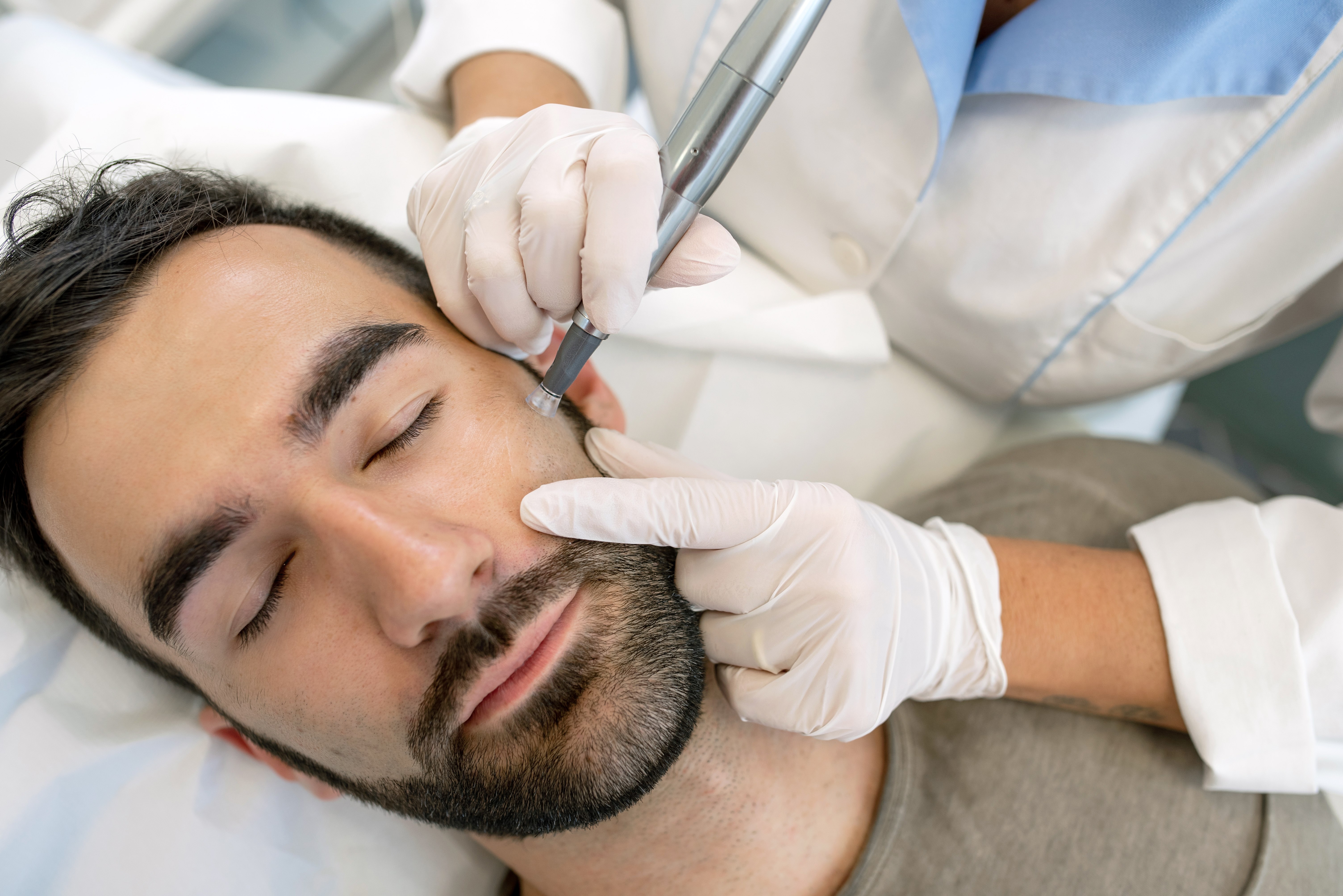 Hauterneuerung durch Microneedling